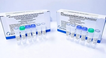 Anvisa autoriza uso emergencial de kits para varíola dos macacos